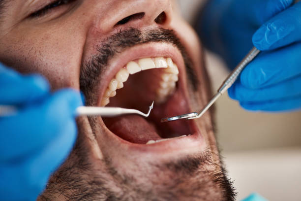 Best Emergency Tooth Extraction in Arcadia, LA