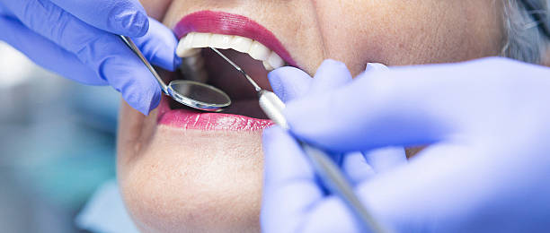 Best Emergency Treatment for Toothache in Arcadia, LA
